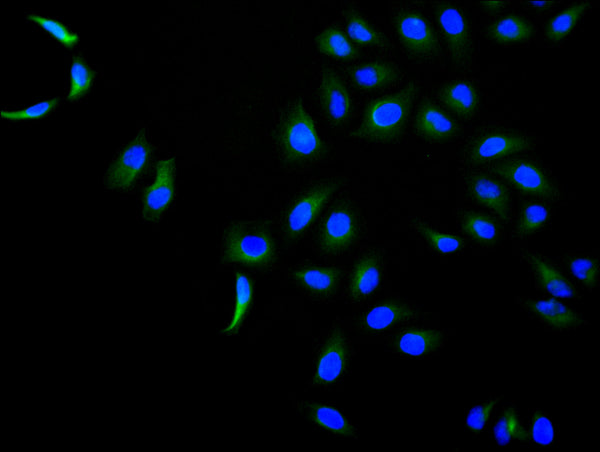 Immunofluorescence staining of Hela cell with CSB-RA822213MA1HU at 1:30 ,counter-stained with DAPI. The cells were fixed in 4% formaldehyde, permeabilized using 0.2% Triton X-100 and blocked in 10% normal Goat Serum. The cells were then incubated with the antibody overnight at 4°C. The secondary antibody was Fluorescein (FITC) AffiniPure Goat Anti-Human IgG, Fcγ fragment specific.