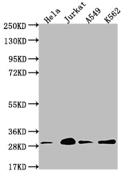 Western Blot
Positive WB detected in: Hela whole cell lysate, Jurkat whole cell lysate, A549 whole cell lysate, K562 whole cell lysate
All lanes: YWHAG antibody at 1:2000
Secondary
Goat polyclonal to rabbit IgG at 1/50000 dilution
Predicted band size: 29 kDa
Observed band size: 29 kDa