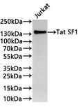 Western Blot
Positive WB detected in: Jurkat whole cell lysate(30µg) 
All lanes: Tat SF1 antibody at 1:1000
Secondary
Goat polyclonal to rabbit IgG at 1/40000 dilution
Predicted band size: 86 kDa
Observed band size: 140 kDa
Exposure time：3min