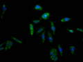 AKR1C3 Antibody – Figure 1 of 2