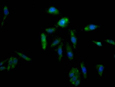 AKR1C3 Antibody – Figure 1 of 2