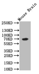 Western Blot
Positive WB detected in: Mouse Brain tissue lysate
All lanes: CHAT antibody at 1:500
Secondary
Goat polyclonal to rabbit IgG at 1/50000 dilution
Predicted band size: 70 kDa
Observed band size: 70 kDa