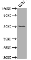 Western Blot
Positive WB detected in: U-251 whole cell lysate
All lanes: Mutant p53 antibody at 1:1000
Secondary
Goat polyclonal to rabbit IgG at 1/50000 dilution
Predicted band size: 38, 39, 40, 34, 35, 30, 24, 25 kDa
Observed band size: 53 kDa