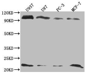 Western Blot
Positive WB detected in: U937 whole cell lysate, U87 whole cell lysate, PC3 whole cell lysate, MCF-7 whole cell lysate
All lanes: LMO2 antibody at 1:2000
Secondary
Goat polyclonal to rabbit IgG at 1/50000 dilution
Predicted band size: 19, 26, 6 kDa
Observed band size: 20-25, 90-100 kDa