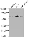 E2F1 Antibody – Figure 1 of 5