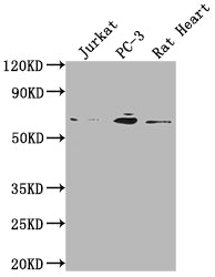 E2F1 Antibody – Figure 1 of 5