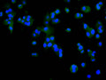 Immunofluorescence staining of HepG2 cell with CSB-RA826572A0HU at 1:50 , counter-stained with DAPI. The cells were fixed in 4% formaldehyde, permeabilized using 0.2% Triton X-100 and blocked in 10% normal Goat Serum. The cells were then incubated with the antibody overnight at 4°C. The secondary antibody was Alexa Fluor 488-congugated AffiniPure Goat Anti-Rabbit IgG(H+L).