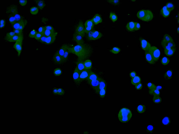 Immunofluorescence staining of HepG2 cell with CSB-RA826572A0HU at 1:50 , counter-stained with DAPI. The cells were fixed in 4% formaldehyde, permeabilized using 0.2% Triton X-100 and blocked in 10% normal Goat Serum. The cells were then incubated with the antibody overnight at 4°C. The secondary antibody was Alexa Fluor 488-congugated AffiniPure Goat Anti-Rabbit IgG(H+L).