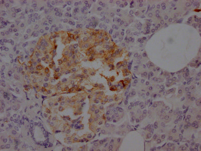 IHC image of CSB-RA827375A0HU diluted at 1:100 and staining in paraffin-embedded human pancreatic tissue performed on a Leica BondTM system. After dewaxing and hydration, antigen retrieval was mediated by high pressure in a citrate buffer (pH 6.0) . Section was blocked with 10% normal goat serum 30min at RT. Then primary antibody (1% BSA) was incubated at 4℃ overnight. The primary is detected by a Goat anti-rabbit IgG polymer labeled by HRP and visualized using 0.05% DAB.