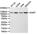 Western Blot
Positive WB detected in: HT-29 whole cell lysate(30µg) , Jurkat whole cell lysate(30µg) , Hela whole cell lysate(30µg) , NIH/3T3 whole cell lysate(30µg) 
All lanes: GART antibody at 1:1000
Secondary
Goat polyclonal to rabbit IgG at 1/40000 dilution
Predicted band size: 108 kDa
Observed band size: 115 kDa
Exposure time：2min