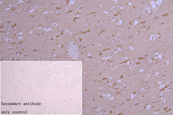 CHRM3 Antibody – Figure 1 of 2