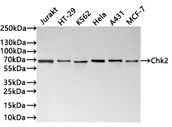 Western Blot
Positive WB detected in: Jurakt whole cell lysate(30µg) , HT-29 whole cell lysate(30µg) , K562 whole cell lysate(30µg) , Hela whole cell lysate(30µg) , A431 whole cell lysate(30µg) , MCF-7 whole cell lysate(30µg) 
All lanes: Chk2 antibody at 1:1000
Secondary
Goat polyclonal to rabbit IgG at 1/40000 dilution
Predicted band size: 61 kDa
Observed band size: 66 kDa
Exposure time：40s