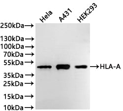 Western Blot
Positive WB detected in: Hela whole cell lysate(30µg) , A431 whole cell lysate(30µg) , HEK293 whole cell lysate(30µg) 
All lanes: HLA-A antibody at 1:1000
Secondary
Goat polyclonal to rabbit IgG at 1/40000 dilution
Predicted band size: 41 kDa
Observed band size: 41 kDa
Exposure time：1min