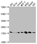 Western Blot
Positive WB detected in: 293 whole cell lysate, Hela whole cell lysate, Jurkat whole cell lysate, MCF-7 whole cell lysate, K562 whole cell lysate, HepG2 whole cell lysate, U87 whole cell lysate
All lanes: SOD1 antibody at 1:1500
Secondary
Goat polyclonal to rabbit IgG at 1/50000 dilution
Predicted band size: 16 kDa
Observed band size: 18 kDa