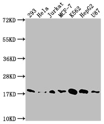Western Blot
Positive WB detected in: 293 whole cell lysate, Hela whole cell lysate, Jurkat whole cell lysate, MCF-7 whole cell lysate, K562 whole cell lysate, HepG2 whole cell lysate, U87 whole cell lysate
All lanes: SOD1 antibody at 1:1500
Secondary
Goat polyclonal to rabbit IgG at 1/50000 dilution
Predicted band size: 16 kDa
Observed band size: 18 kDa