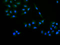 Immunofluorescence staining of Hela cell with CSB-RA830757A0HU at 1:50 , counter-stained with DAPI. The cells were fixed in 4% formaldehyde, permeabilized using 0.2% Triton X-100 and blocked in 10% normal Goat Serum. The cells were then incubated with the antibody overnight at 4°C. The secondary antibody was Alexa Fluor 488-congugated AffiniPure Goat Anti-Rabbit IgG(H+L).