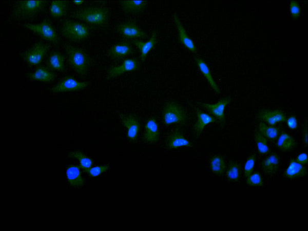 Immunofluorescence staining of Hela cell with CSB-RA830757A0HU at 1:50 , counter-stained with DAPI. The cells were fixed in 4% formaldehyde, permeabilized using 0.2% Triton X-100 and blocked in 10% normal Goat Serum. The cells were then incubated with the antibody overnight at 4°C. The secondary antibody was Alexa Fluor 488-congugated AffiniPure Goat Anti-Rabbit IgG(H+L).