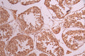 IHC image of CSB-RA831539A0HU diluted at 1:100 and staining in paraffin-embedded human testis tissue performed on a Leica BondTM system. After dewaxing and hydration, antigen retrieval was mediated by high pressure in a citrate buffer (pH 6.0) . Section was blocked with 10% normal goat serum 30min at RT. Then primary antibody (1% BSA) was incubated at 4°C overnight. The primary is detected by a Goat anti-rabbit polymer IgG labeled by HRP and visualized using 0.05% DAB.