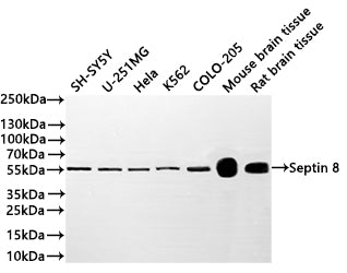 Western Blot
Positive WB detected in: SH-SY5Y whole cell lysate(20µg) ,U-251MG whole cell lysate(20µg) , Hela whole cell lysate(20µg) , K562 whole cell lysate(20µg) ,COLO-205 whole cell lysate(20µg) , Mouse brain tissue lysate(20µg) , Rat brain tissue lysate(20µg) 
All lanes: Septin 8 antibody at 1:1000
Secondary
Goat polyclonal to rabbit IgG at 1/40000 dilution
Predicted band size: 56 kDa
Observed band size: 56 kDa
Exposure time：2min