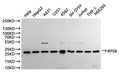 Western Blot
Positive WB detected in: Hela whole cell lysate(30µg), HepG2 whole cell lysate(30µg), A431 whole cell lysate(30µg), U-251MG whole cell lysate(30µg), K562 whole cell lysate(30µg), SH-SY5Y whole cell lysate(30µg), Jurkat whole cell lysate(30µg), THP-1 whole cell lysate(30µg), HEK293 whole cell lysate(30µg)
All lanes: RPS8 antibody at 1:1000
Secondary
Goat polyclonal to rabbit IgG at 1/40000 dilution
Predicted band size: 24 kDa
Observed band size: 30 kDa
Exposure time：30s