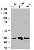 Western Blot
Positive WB detected in: HepG2 whole cell lysate, HEK293 whole cell lysate, PC-3 whole cell lysate
All lanes: NTHL1 antibody at 1:1000
Secondary
Goat polyclonal to rabbit IgG at 1/50000 dilution
Predicted band size: 35, 34, 33 kDa
Observed band size: 35 kDa