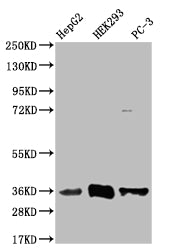 Western Blot
Positive WB detected in: HepG2 whole cell lysate, HEK293 whole cell lysate, PC-3 whole cell lysate
All lanes: NTHL1 antibody at 1:1000
Secondary
Goat polyclonal to rabbit IgG at 1/50000 dilution
Predicted band size: 35, 34, 33 kDa
Observed band size: 35 kDa