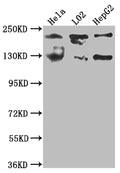 Western Blot
Positive WB detected in: Hela whole cell lysate, L02 whole cell lysate, HepG2 whole cell lysate
All lanes: MGEA5 antibody at 1:1000
Secondary
Goat polyclonal to rabbit IgG at 1/50000 dilution
Predicted band size: 103, 96, 77, 97 kDa
Observed band size: 130 kDa