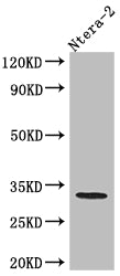 Western Blot
Positive WB detected in: Ntera-2 whole cell lysate
All lanes: pro Caspase 3 antibody at 1:1000
Secondary
Goat polyclonal to rabbit IgG at 1/50000 dilution
Predicted band size: 32 kDa
Observed band size: 32 kDa