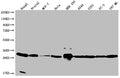 Western Blot
Positive WB detected in: HepG2 whole cell lysate, Ntera-2 whole cell lysate, MCF-7 whole cell lysate, Hela whole cell lysate, HEK293 whole cell lysate, A549 whole cell lysate, U251 whole cell lysate, PC3 whole cell lysate, U87 whole cell lysate
All lanes: BCAP31 antibody at 1:2000
Secondary
Goat polyclonal to rabbit IgG at 1/50000 dilution
Predicted band size: 28, 35 kDa
Observed band size: 28-36 kDa