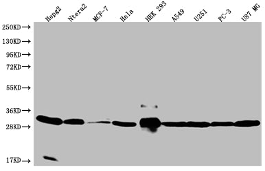 Western Blot
Positive WB detected in: HepG2 whole cell lysate, Ntera-2 whole cell lysate, MCF-7 whole cell lysate, Hela whole cell lysate, HEK293 whole cell lysate, A549 whole cell lysate, U251 whole cell lysate, PC3 whole cell lysate, U87 whole cell lysate
All lanes: BCAP31 antibody at 1:2000
Secondary
Goat polyclonal to rabbit IgG at 1/50000 dilution
Predicted band size: 28, 35 kDa
Observed band size: 28-36 kDa