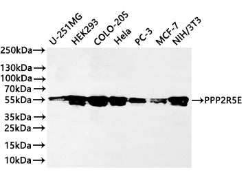 Western Blot
Positive WB detected in: U-251MG whole cell lysate(30µg) , HEK293 whole cell lysate(30µg) , COLO-205 whole cell lysate(30µg) , Hela whole cell lysate(30µg) , PC-3 whole cell lysate(30µg) , MCF-7 whole cell lysate(30µg) , NIH/3T3 whole cell lysate(30µg) 
All lanes: PPP2R5E polymerase beta antibody at 1:1000
Secondary
Goat polyclonal to rabbit IgG at 1/40000 dilution
Predicted band size: 55 kDa
Observed band size: 50 kDa
Exposure time：3min