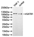 Western Blot
Positive WB detected in: THP-1 whole cell lysate(30µg) , Jurkat whole cell lysate(30µg) 
All lanes: SATB1 antibody at 1:1000
Secondary
Goat polyclonal to rabbit IgG at 1/50000 dilution
Predicted band size: 86 kDa
Observed band size: 100 kDa
Exposure time: 2min