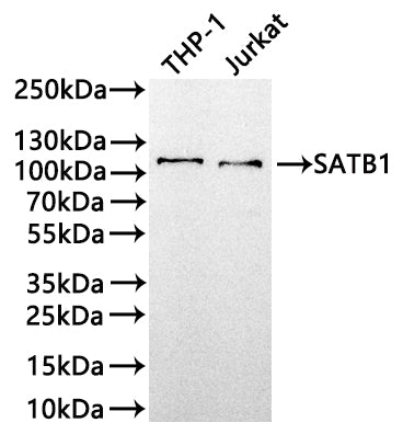 Western Blot
Positive WB detected in: THP-1 whole cell lysate(30µg) , Jurkat whole cell lysate(30µg) 
All lanes: SATB1 antibody at 1:1000
Secondary
Goat polyclonal to rabbit IgG at 1/50000 dilution
Predicted band size: 86 kDa
Observed band size: 100 kDa
Exposure time: 2min