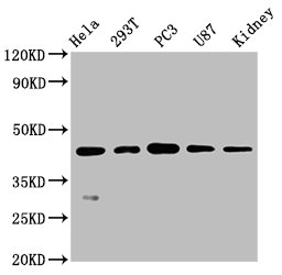 Western Blot
Positive WB detected in: Hela whole cell lysate, 293T whole cell lysate, PC3 whole cell lysate, U87 whole cell lysate, Mouse kidney tissue
All lanes: NDRG1 antibody at 0.7μg/ml
Secondary
Goat polyclonal to rabbit IgG at 1/50000 dilution
Predicted band size: 43, 36, 34 KDa
Observed band size: 43 KDa