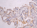 IHC image of CSB-RA835695MA1HU diluted at 1:200 and staining in paraffin-embedded human placenta tissue performed on a Leica BondTM system. After dewaxing and hydration, antigen retrieval was mediated by high pressure in a citrate buffer (pH 6.0) . Section was blocked with 10% normal goat serum 30min at RT. Then primary antibody (1% BSA) was incubated at 4°C overnight. The primary is detected by a Goat anti-human polymer IgG labeled by HRP and visualized using 0.05% DAB.