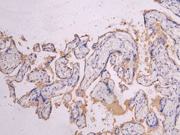 IHC image of CSB-RA835695MA1HU diluted at 1:200 and staining in paraffin-embedded human placenta tissue performed on a Leica BondTM system. After dewaxing and hydration, antigen retrieval was mediated by high pressure in a citrate buffer (pH 6.0) . Section was blocked with 10% normal goat serum 30min at RT. Then primary antibody (1% BSA) was incubated at 4°C overnight. The primary is detected by a Goat anti-human polymer IgG labeled by HRP and visualized using 0.05% DAB.