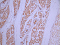 IHC image of CSB-RA839361MA1HU diluted at 1:50 and staining in paraffin-embedded human skin tissue performed on a Leica BondTM system. After dewaxing and hydration, antigen retrieval was mediated by high pressure in a citrate buffer (pH 6.0). Section was blocked with 10% normal goat serum 30min at RT. Then primary antibody (1% BSA) was incubated at 4°C overnight. The primary is detected by a Anti-Human lgG, Fcy Fragment Specific labeled by HRP and visualized using 0.05% DAB.