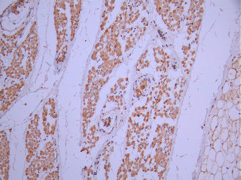 IHC image of CSB-RA839361MA1HU diluted at 1:50 and staining in paraffin-embedded human skin tissue performed on a Leica BondTM system. After dewaxing and hydration, antigen retrieval was mediated by high pressure in a citrate buffer (pH 6.0). Section was blocked with 10% normal goat serum 30min at RT. Then primary antibody (1% BSA) was incubated at 4°C overnight. The primary is detected by a Anti-Human lgG, Fcy Fragment Specific labeled by HRP and visualized using 0.05% DAB.