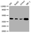 Western Blot
Positive WB detected in: 293 whole cell lysate, HepG2 whole cell lysate, Jurkat whole cell lysate, THP-1 whole cell lysate
All lanes: TMEM173 antibody at 1:1000
Secondary
Goat polyclonal to rabbit IgG at 1/50000 dilution
Predicted band size: 43 kDa
Observed band size: 43 kDa