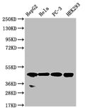 Western Blot
Positive WB detected in: HepG2 whole cell lysate, Hela whole cell lysate, PC-3 whole cell lysate, HEK293 whole cell lysate
All lanes: NSDHL antibody at 1:1000
Secondary
Goat polyclonal to rabbit IgG at 1/50000 dilution
Predicted band size: 42 kDa
Observed band size: 42 kDa