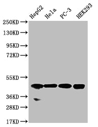 Western Blot
Positive WB detected in: HepG2 whole cell lysate, Hela whole cell lysate, PC-3 whole cell lysate, HEK293 whole cell lysate
All lanes: NSDHL antibody at 1:1000
Secondary
Goat polyclonal to rabbit IgG at 1/50000 dilution
Predicted band size: 42 kDa
Observed band size: 42 kDa