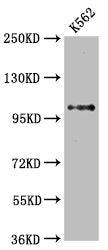 Western Blot
Positive WB detected in: K562 whole cell lysate
All lanes: DGCR8 antibody at 2.65μg/ml
Secondary
Goat polyclonal to rabbit IgG at 1/50000 dilution
Predicted band size: 87, 33, 83 KDa
Observed band size: 100 KDa