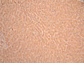 IHC image of CSB-RA847747MA2HU diluted at 1:50 and staining in paraffin-embedded human liver tissue performed on a Leica BondTM system. After dewaxing and hydration, antigen retrieval was mediated by high pressure in a citrate buffer (pH 6.0). Section was blocked with 10% normal goat serum 30min at RT. Then primary antibody (1% BSA) was incubated at 4°C overnight. The primary is detected by a Anti-Human lgG, Fcy Fragment Specific labeled by HRP and visualized using 0.05% DAB.