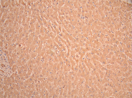 IHC image of CSB-RA847747MA2HU diluted at 1:50 and staining in paraffin-embedded human liver tissue performed on a Leica BondTM system. After dewaxing and hydration, antigen retrieval was mediated by high pressure in a citrate buffer (pH 6.0). Section was blocked with 10% normal goat serum 30min at RT. Then primary antibody (1% BSA) was incubated at 4°C overnight. The primary is detected by a Anti-Human lgG, Fcy Fragment Specific labeled by HRP and visualized using 0.05% DAB.