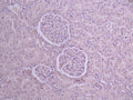 IHC image of CSB-RA848820MA1HU diluted at 1：50 and staining in paraffin-embedded human kidney tissue performed on a Leica BondTM system. After dewaxing and hydration, antigen retrieval was mediated by high pressure in a citrate buffer (pH 6.0) . Section was blocked with 10% normal goat serum 30min at RT. Then primary antibody (1% BSA) was incubated at 4°C overnight. The primary is detected by a Anti-Human lgG, Fcy Fragment Specific labeled by HRP and visualized using 0.05% DAB.