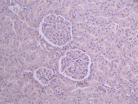 IHC image of CSB-RA848820MA1HU diluted at 1：50 and staining in paraffin-embedded human kidney tissue performed on a Leica BondTM system. After dewaxing and hydration, antigen retrieval was mediated by high pressure in a citrate buffer (pH 6.0) . Section was blocked with 10% normal goat serum 30min at RT. Then primary antibody (1% BSA) was incubated at 4°C overnight. The primary is detected by a Anti-Human lgG, Fcy Fragment Specific labeled by HRP and visualized using 0.05% DAB.