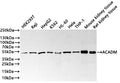 Western Blot
Positive WB detected in: HEK293T whole cell lysate(30µg) , Raji whole cell lysate(30µg) , HepG2 whole cell lysate(30µg) , K562 whole cell lysate(30µg) , HL-60 whole cell lysate(30µg) , Hela whole cell lysate(30µg) , THP-1 whole cell lysate(30µg) , Mouse kidney tissue lysate(30µg) , Rat kidney tissue lysate(30µg) 
All lanes: ACADM antibody at 1:1000
Secondary
Goat polyclonal to rabbit IgG at 1/40000 dilution
Predicted band size: 47 kDa
Observed band size: 47 kDa
Exposure time：40s