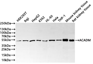 Western Blot
Positive WB detected in: HEK293T whole cell lysate(30µg) , Raji whole cell lysate(30µg) , HepG2 whole cell lysate(30µg) , K562 whole cell lysate(30µg) , HL-60 whole cell lysate(30µg) , Hela whole cell lysate(30µg) , THP-1 whole cell lysate(30µg) , Mouse kidney tissue lysate(30µg) , Rat kidney tissue lysate(30µg) 
All lanes: ACADM antibody at 1:1000
Secondary
Goat polyclonal to rabbit IgG at 1/40000 dilution
Predicted band size: 47 kDa
Observed band size: 47 kDa
Exposure time：40s