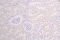 IHC image of CSB-RA858415MA1HU diluted at 1：100 and staining in paraffin-embedded human kidney tissue performed on a Leica BondTM system. After dewaxing and hydration, antigen retrieval was mediated by high pressure in a citrate buffer (pH 6.0) . Section was blocked with 10% normal goat serum 30min at RT. Then primary antibody (1% BSA) was incubated at 4°C overnight. The primary is detected by a Goat anti-human polymer IgG labeled by HRP and visualized using 0.05% DAB.