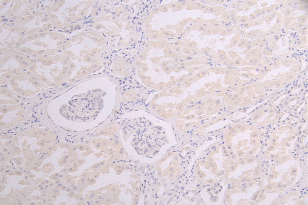 IHC image of CSB-RA858415MA1HU diluted at 1：100 and staining in paraffin-embedded human kidney tissue performed on a Leica BondTM system. After dewaxing and hydration, antigen retrieval was mediated by high pressure in a citrate buffer (pH 6.0) . Section was blocked with 10% normal goat serum 30min at RT. Then primary antibody (1% BSA) was incubated at 4°C overnight. The primary is detected by a Goat anti-human polymer IgG labeled by HRP and visualized using 0.05% DAB.